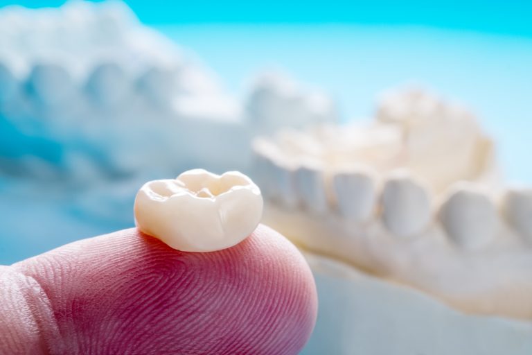 Pediatric Crowns Upbeat Pediatric Dentistry