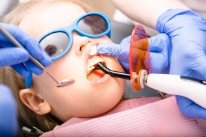 pediatric dentist for fillings